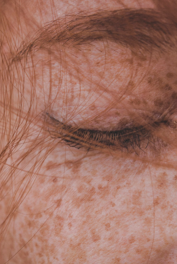 Tratamientos faciales